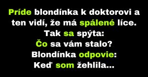 Blondínka príde k doktorovi so spáleným lícom (Vtip)